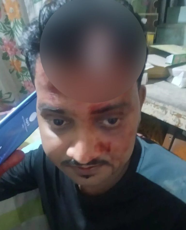 বোয়ালখালীতে পাওনা টাকা চাওয়াকে কেন্দ্র করে হামলা—এক ব্যক্তির রক্তাক্ত জখম, থানায় অভিযোগ দায়ের